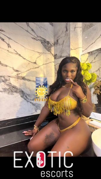 Sugar Baby — 2